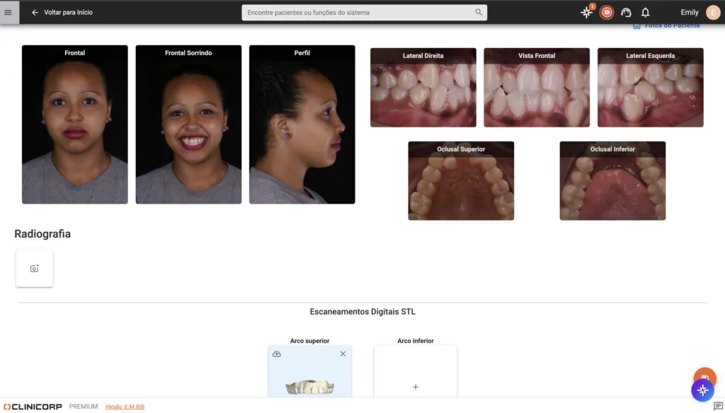 Imagem do Diagnóstico Digital do software odontológico Clinicorp, exibindo fotos intraorais e extraorais do paciente nas vistas frontal, lateral, oclusal e sorriso, recurso para planejamento de tratamentos com alinhadores invisíveis.