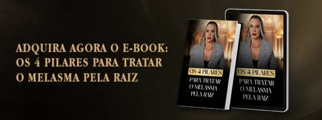 E-book de Marina Feld: os 4 pilares para tratar o melasma pela raiz