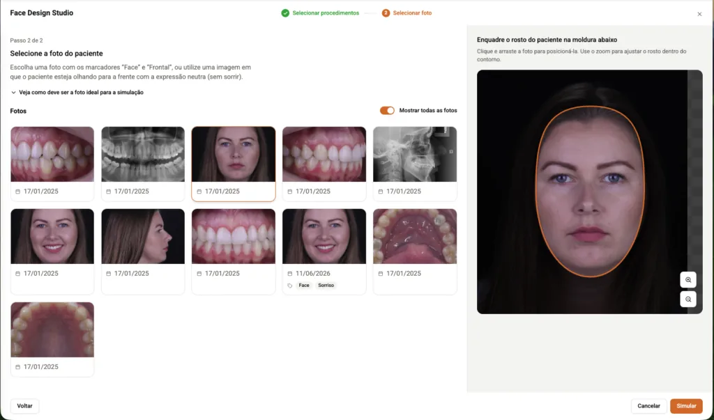Face Design Studio do software odontológico Clinicorp.