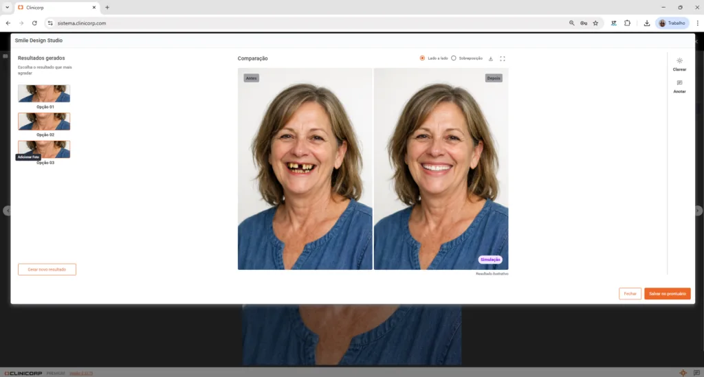 Tela do Clinicorp IA com a simulação de sorriso do Smile Design Studio