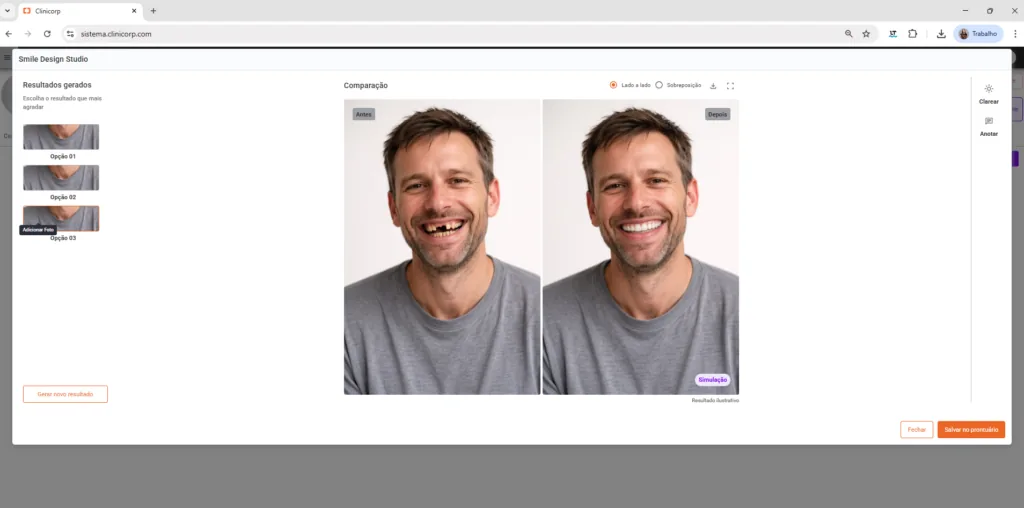 Tela do Clinicorp IA com a simulação de sorriso do Smile Design Studio
