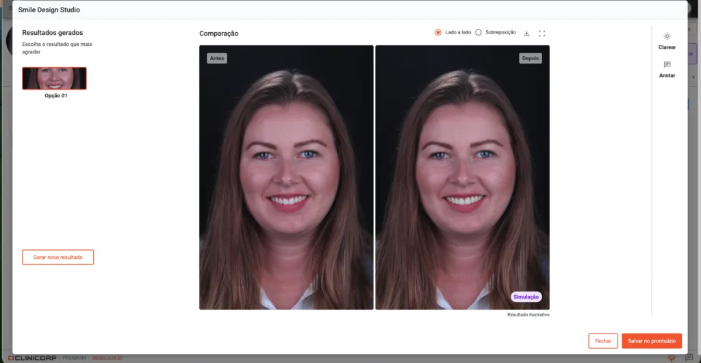 Simulação de sorriso antes e depois no Smile Design Studio do Clinicorp, ferramenta de planejamento ortodôntico com inteligência artificial.