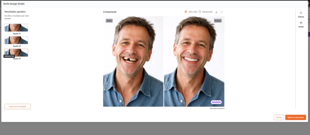 Smile Design Studio comparando o antes e o depois da simulação de sorriso de um paciente