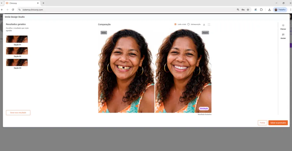 Tela do Clinicorp IA com a simulação de sorriso do Smile Design Studio