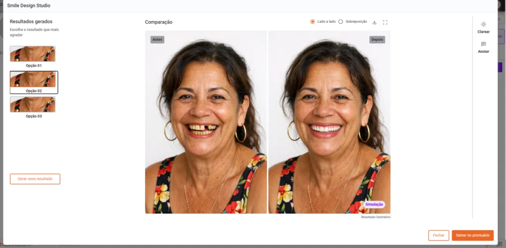 Simulação de sorriso feita no Smile Design Studio do Clinicorp IA
