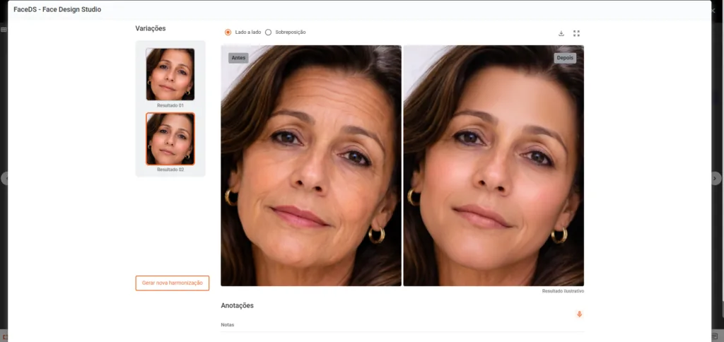 Simulação de sorriso feita no Smile Design Studio do Clinicorp IA
