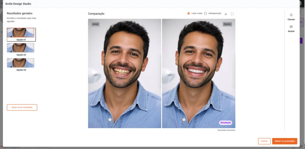 Simulação de sorriso feita no Smile Design Studio do Clinicorp IA