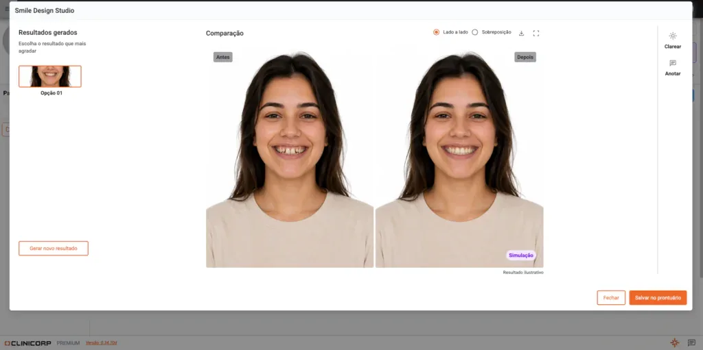 Smile Design Studio do Clinicorp comparando o antes e o depois da simulação de sorriso