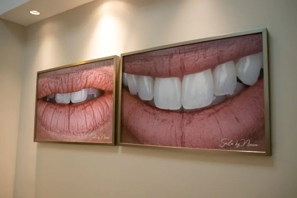 Quadros com fotos de close de sorriso decorando a parede de um consultório odontológico