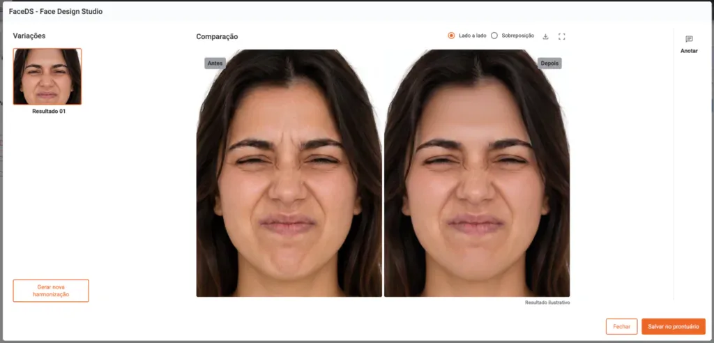 Sistema de gestão estética: simulação de aplicação de toxina butolínica criada utilizado a funcionalidade FaceDS dentro do sistema Clinicorp.