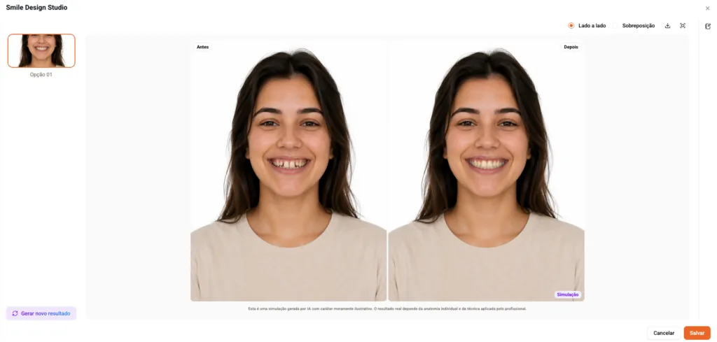 Captura de tela da funcionalidade do Smile Design Studio, do software odontológico Clinicorp, gerando um resultado de um tratamento ortodôntico antes mesmo de o paciente iniciá-lo.