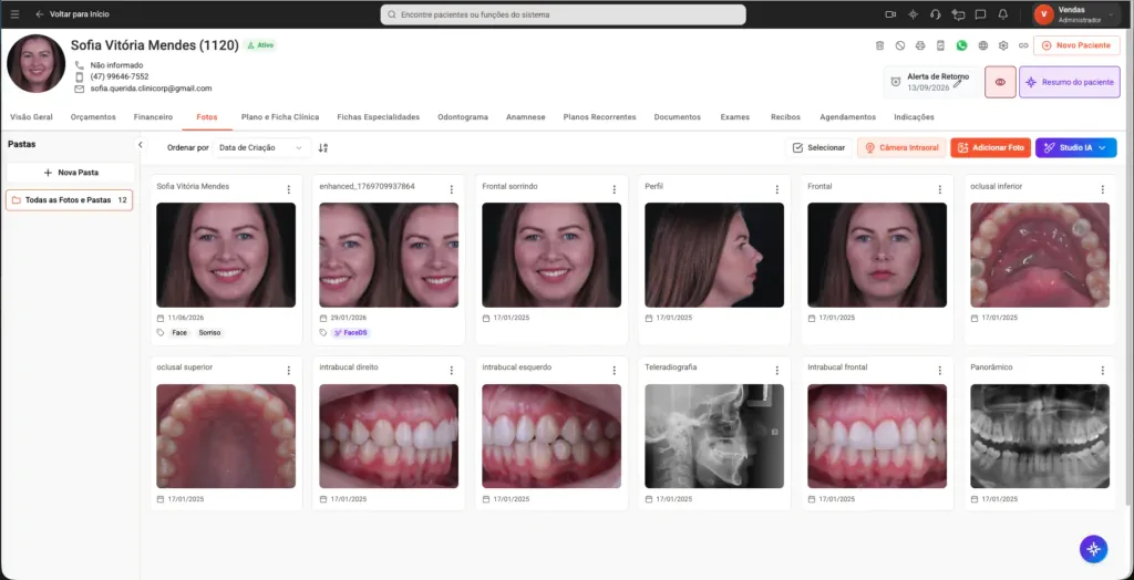 Tela de “Prontuário Eletrônico” do software odontológico Clinicorp para tratamento de canal dentário.