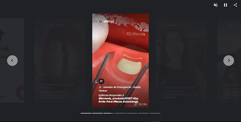 tiktok para dentistas, imagem de um vídeo mostrando o implante de um dente
